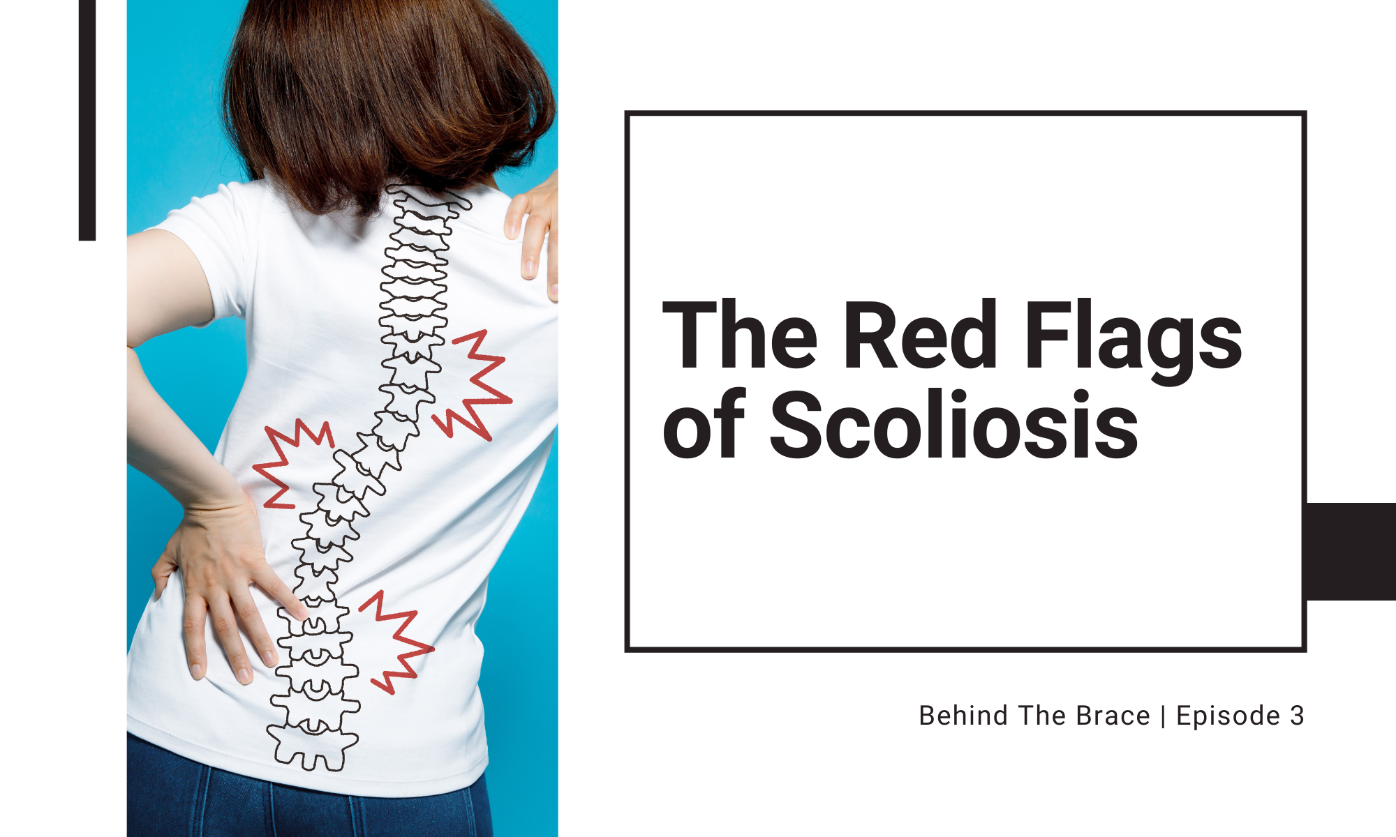 The Red Flags of Scoliosis